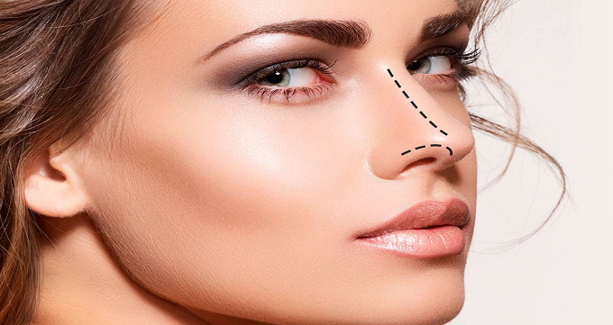 عمل بینی گوشتی زنانه