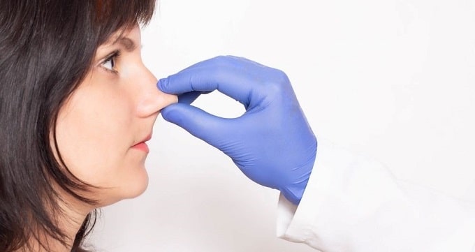 جراحی بینی یا رینوپلاستی چیست ؟
