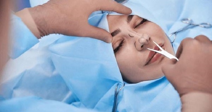 رینوپلاستی بسته