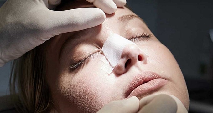 عوارض جراحی بینی گوشتی