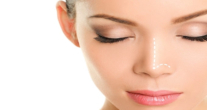 بهترین دکتر عمل بینی در تهران