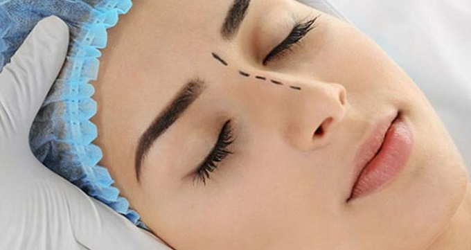 عمل بینی طبیعی زنانه