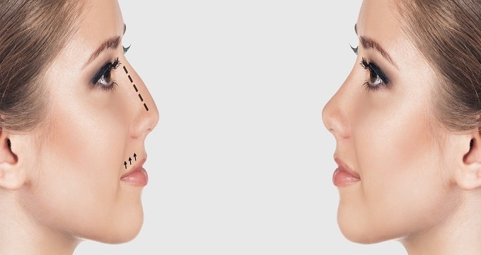 بینی طبیعی بهتر است یا بینی نیمه فانتزی ؟