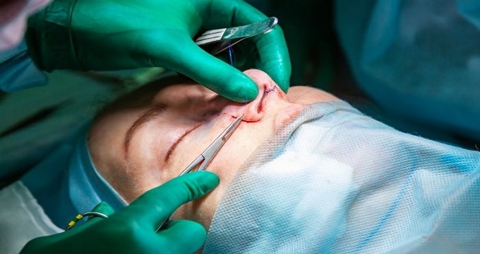 جراحی بینی چیست ؟