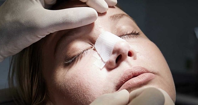 تفاوت جراحی بینی باز و بسته