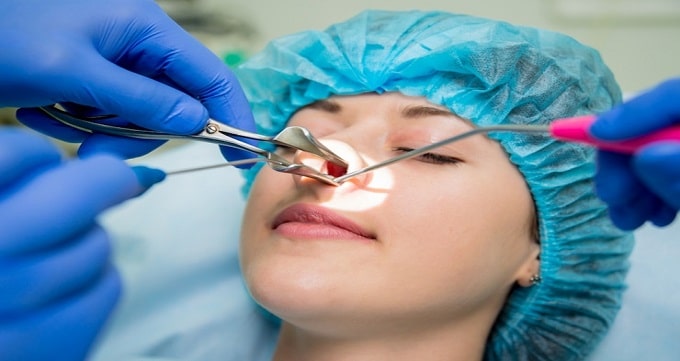 مراقبت های قبل از جراحی بینی طبیعی