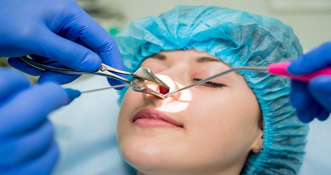 بهترین جراح بینی استخوانی در ونک