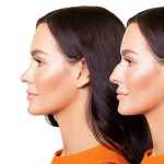 راهنمای جامع جراحی ترمیمی بینی؛ مراحل، هزینه و بایدها و نبایدها